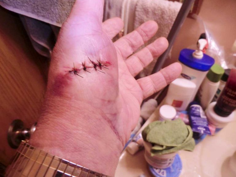 Accidents on the farm can happen in the blink of an eye