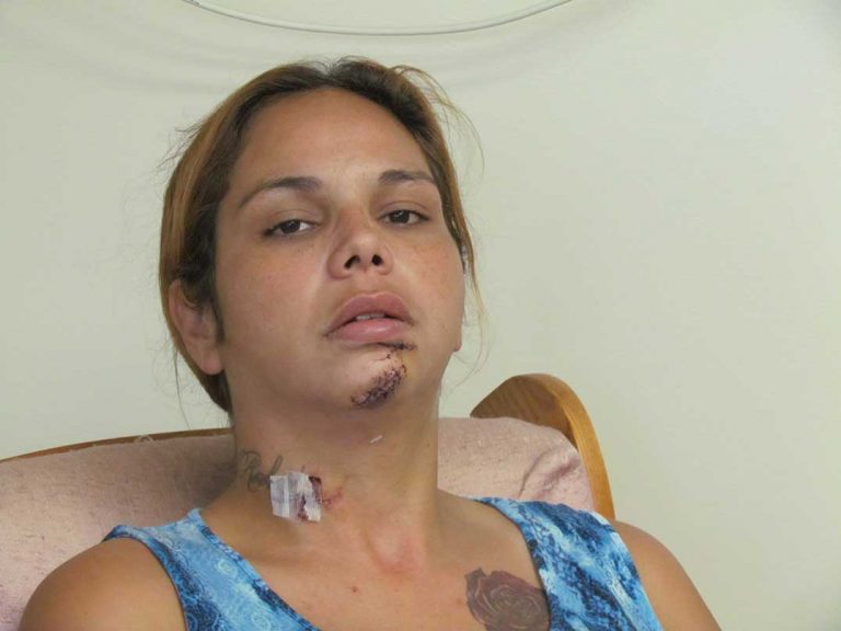 Mindemoya stabbing at Meadowview Apartments raises safety concerns