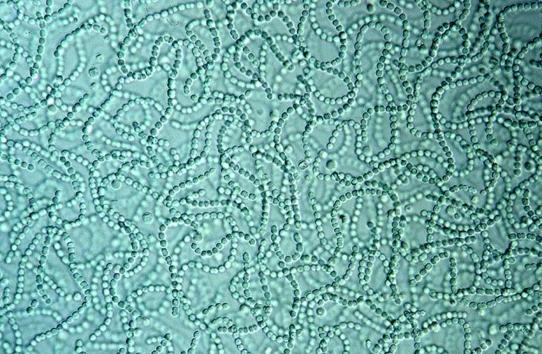 Public Health Sudbury & Districts issues advisory due to possible blue-green algal bloom at Moonlight beach on Lake Ramsey